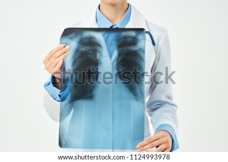 x-ray picture of thorax doctor                            
