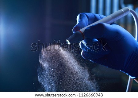 Periodontal ultrasonic scalers are dental instruments used primarily in the prophylactic and periodontal care of human teeth tartar removal. ultrasonic scaler  in a hand in a blue glove. Royalty-Free Stock Photo #1126660943