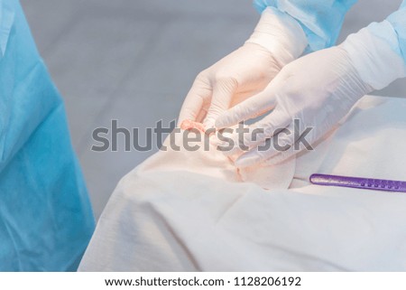 hands of surgeon doctor doing surgery on woman's toe. Concept photo of professional medicine
