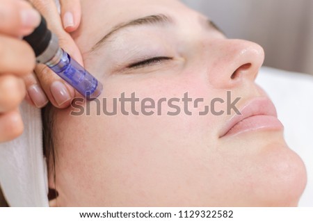 Hardware cosmetology, mesotherapy, treatment of cheek zone, face rejuvenation, close up Royalty-Free Stock Photo #1129322582