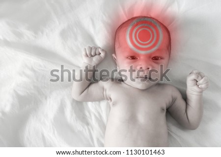 Asian born Little Baby on white cotton.Sick baby, pale picture and Red circle showing sickness
(brain, headache,)