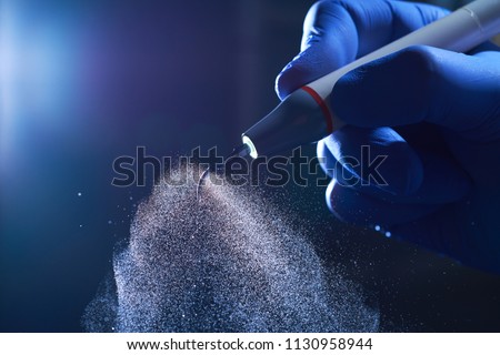 Periodontal ultrasonic scalers are dental instruments used primarily in the prophylactic and periodontal care of human teeth tartar removal. ultrasonic scaler  in a hand in a blue glove. Royalty-Free Stock Photo #1130958944
