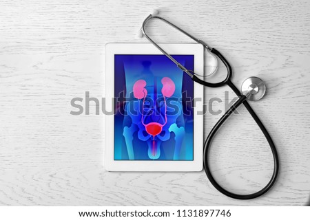 Tablet displaying urinary system and stethoscope on wooden background. Urology concept Royalty-Free Stock Photo #1131897746