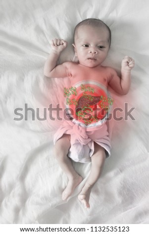 Asian born Little Baby on white cotton.Sick baby, pale picture and Red circle showing sickness
( liver)
