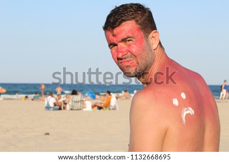 Sad man after overexposing himself to the sun 