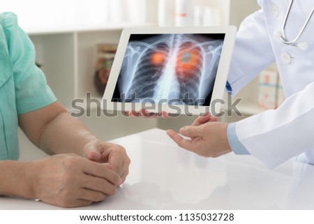 lung cancer concept. doctor explaining results of lung check up from x-ray scan chest on digital tablet screen to patient. Royalty-Free Stock Photo #1135032728