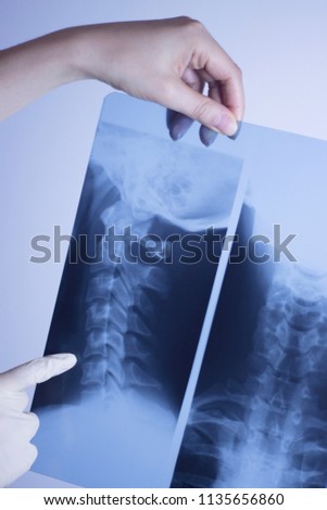 Medical hospital x-ray lowe back pain spine and neck traumatology scan.
