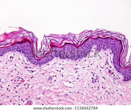 Epidermis of the thin skin. It can be identified the stratum basale, spinosum, a narrow stratum granulosum and a superficial well defined stratum corneum. The epidermis rest over the dermis. Royalty-Free Stock Photo #1136062784