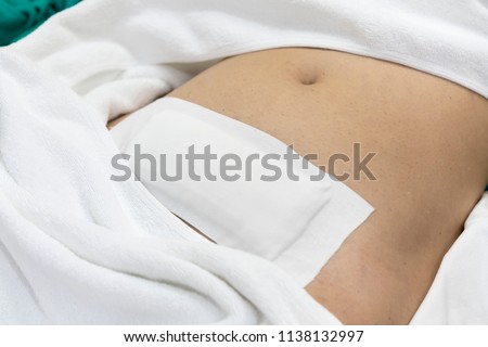 After having Hysterectomy surgery by laparotomic myomectomy , patient given waterproof bandages for stitches