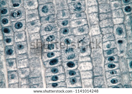 Mitosis cell of root tip onion under microscope for biological education Royalty-Free Stock Photo #1141014248