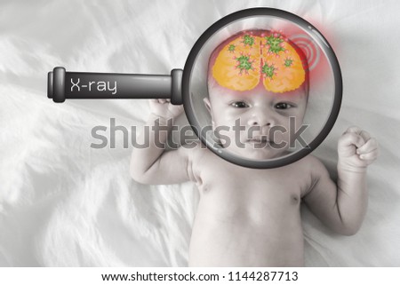Asian born Little Baby on white cotton.Sick baby, pale picture and Red circle showing sickness
(brain),X-Ray Glasses
The concept of disease presentation is easy to understand.

