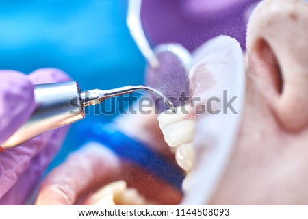 Dentist making professional teeth cleaning and polishing female young patient by ultrasonic scaler at the dental office. Oeration of cleaning female mouth Medical dentist teeth polishing Close-up plan Royalty-Free Stock Photo #1144508093