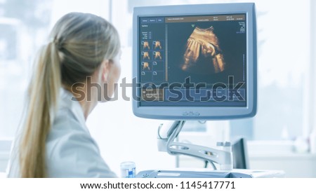 In the Hospital, Obstetrician Uses Transducer for Ultrasound/ Sonogram Screening / Scanning Belly of the Pregnant Woman. Computer Screen Shows 3D Image of the Healthy Forming Baby. Royalty-Free Stock Photo #1145417771