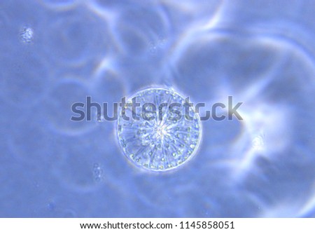 Phase contrast picture of marine diatom in sea water under light microscope in laboratory which have genus name in latin language is "Asteromphalus". Phytoplankton that live in the sea and ocean.