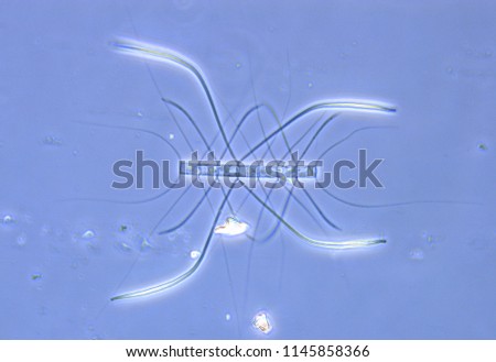 Colony of marine organisms which have genus name in latin language call "Chaetoceros". Phase contrast picture of marine diatoms under light microscope. Phytoplankton that live in the sea and ocean.