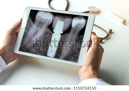 Dentist watching a dental x-ray teeth with dental pivot on digital tablet. 