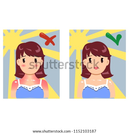 Vector illustration about skin sun protection in flat style. Before and after.