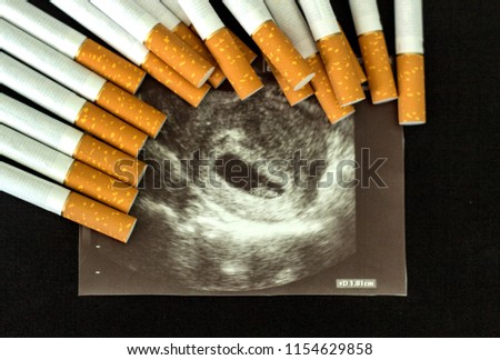 Cigarettes in the picture of pregnancy, pregnancy and smoking, cigarette
