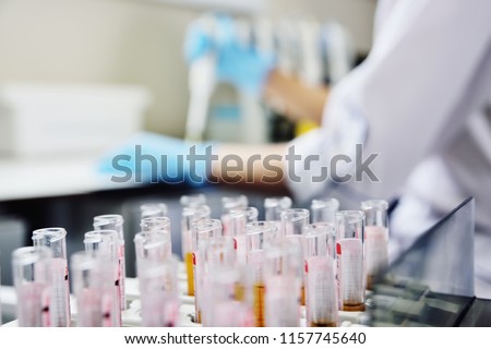 A scientist in a medical laboratory with a dispenser in his hands is doing an analysis