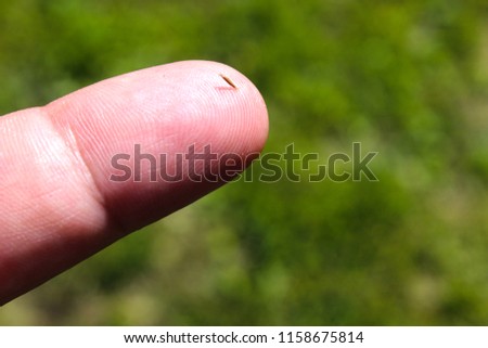 A splinter in the finger close-up. Royalty-Free Stock Photo #1158675814