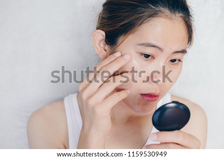 Portrait of Asian woman worry about her face when she saw the problem of acne and scar by the mini mirror. Conceptual shot of Acne and Problem Skin on female face. Royalty-Free Stock Photo #1159530949