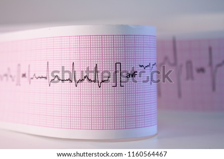 Electrocardiographic tracings of humans. Heartbeats represented on paper. Approach millimeter paper. Royalty-Free Stock Photo #1160564467