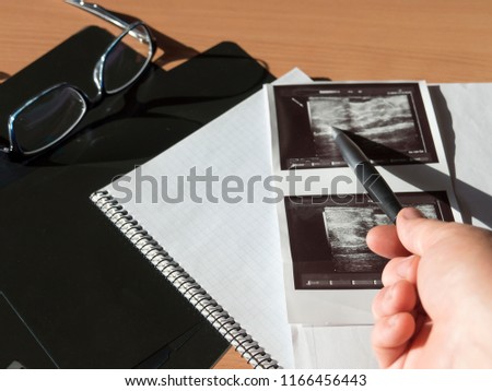 Mammography. The doctor examines pictures of the patient with fibroadenomatosis and the result of ultrasound.