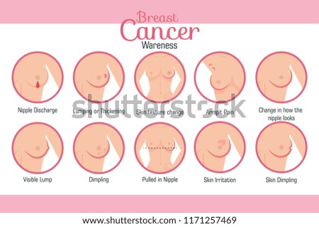 types of appearances of the breast Royalty-Free Stock Photo #1171257469