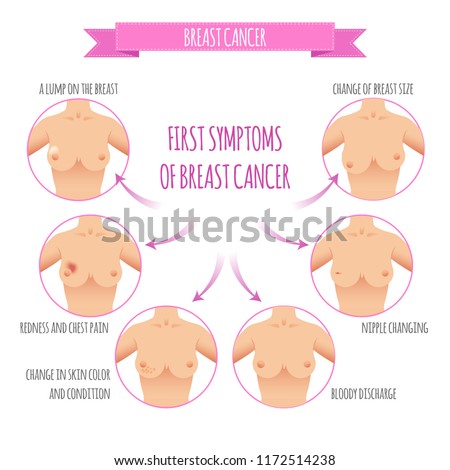 Breast cancer awareness. Info for Self-examination. Vector illustration Symptoms, diagnostics. Medicine, pathology, anatomy, physiology, health Healthcare poster or ads