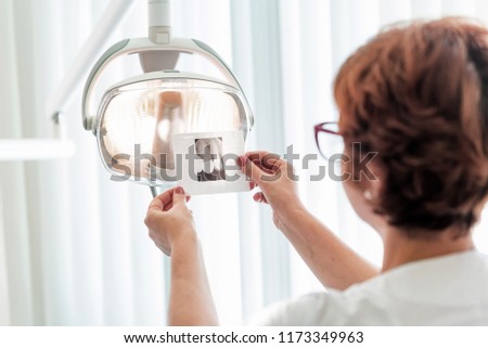 A dentist examines x ray in her hands