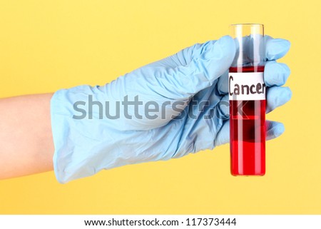 Test tube labeled Cancer in hand on yellow background