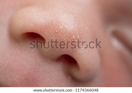 Macro, close-up shot of the milia on a two day old baby cheek
, nose and forehead. Royalty-Free Stock Photo #1174366048