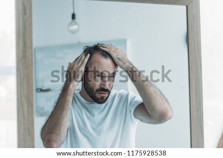 middle aged man with alopecia looking at mirror, hair loss concept  Royalty-Free Stock Photo #1175928538