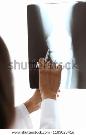 Female black doctor hold in arm and look at xray photography discussing it with female patient portrait. Bone disease exam medic assistance cancer test healthy lifestyle hospital practice concept