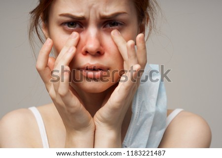 unhealthy appearance of a woman red spots on the face                         Royalty-Free Stock Photo #1183221487