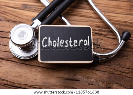 Cholesterol Word Written On Slate With Stethoscope On Wooden Table Royalty-Free Stock Photo #1185761638