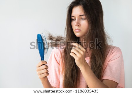 Young woman is very upset because of hair loss Royalty-Free Stock Photo #1186035433