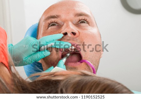 Close up picture of dentist using drill for dental treatment - male patient's oral cavity