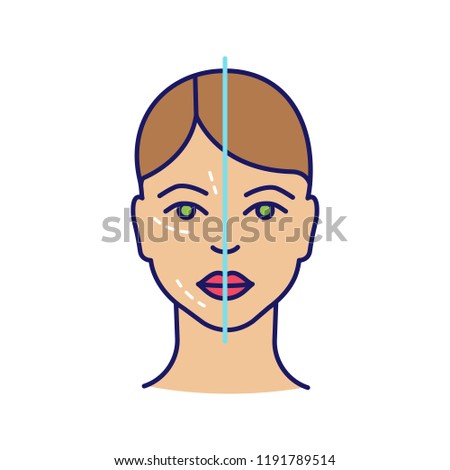 Before and after neurotoxin injection color icon. Cosmetic procedure. Facial rejuvenation. Aesthetic medicine. Cosmetology. Isolated vector illustration