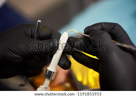 Close-up of a dentist in black gloves prepares the material for filling the tooth canal. Modern dentistry. Macro photography.