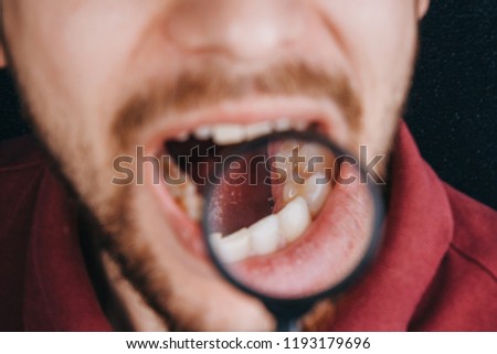 human larynx close up. under the magnifying glass. sore throat, cold, swelling Royalty-Free Stock Photo #1193179696