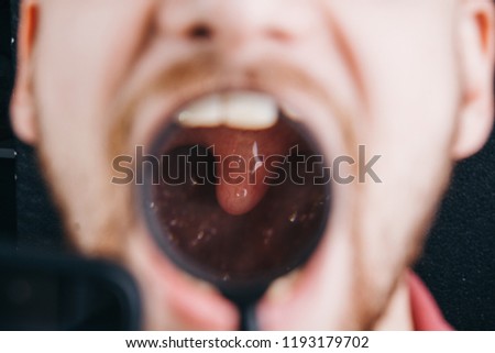 human larynx close up. under the magnifying glass. sore throat, cold, swelling Royalty-Free Stock Photo #1193179702