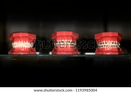 three varieties of artificial jaws with metal braces on a dark background with space for text