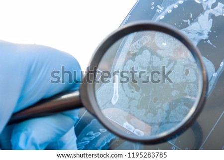 Doctor examines MRI snapshot of abdomen organs, large and small  intestines. Careful diagnosis rare and occurs widely intestines diseases such as irritable bowel syndrome, Crohn's disease  Royalty-Free Stock Photo #1195283785