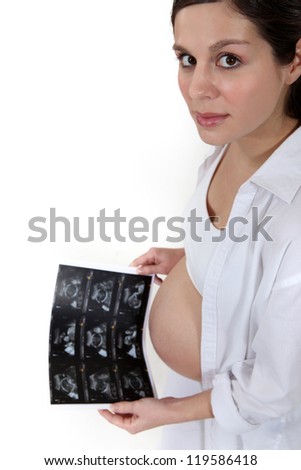 Pregnant woman holding x-ray image