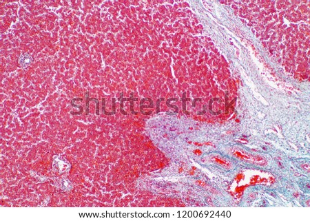 Human liver tissue under the microscope view. Histological for human physiology. Royalty-Free Stock Photo #1200692440