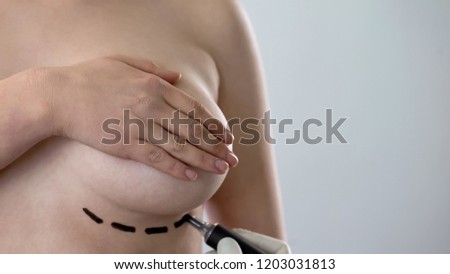 Surgeon drawing lines on ladys breast for augmentation surgery, body positivity