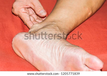 Severe gout in men suffering from joint pain, bone pain, gout, rheumatoid symptoms, radioactive sickness, ill man concept of male osteoporosis, injured bone, injury, pain, arthritis,arm, foot, knee