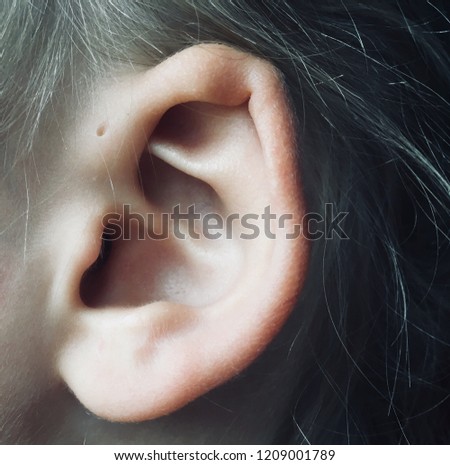 Unique holes near the ear.