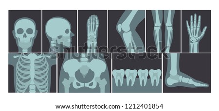Vector illustration set of many X-rays shots of human body, X-ray pictures of head, hands, legs and other parts of body on white background. Royalty-Free Stock Photo #1212401854